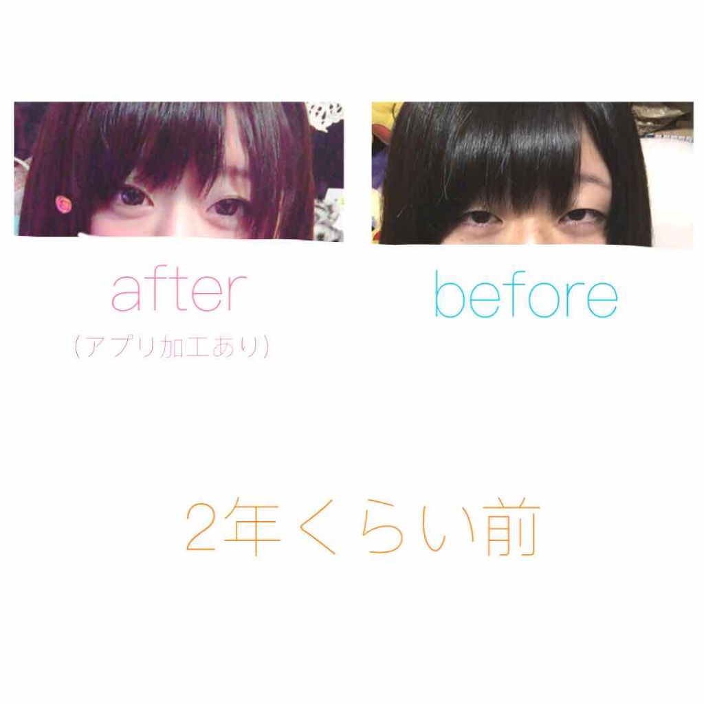 ROYAL ローヤルアイムのクチコミ「私が二重にしていた頃の話をします。

高校3年の終わりごろに化粧を初めて4年半くらいアイプチを.....」（1枚目）