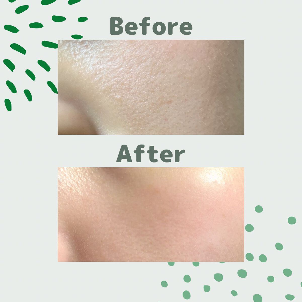 リードルショット300/VT/美容液を使ったクチコミ（2枚目）