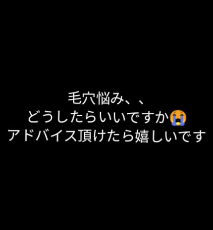 ロゼット洗顔パスタ アクネクリア/ロゼット/洗顔フォームを使ったクチコミ(1枚目)