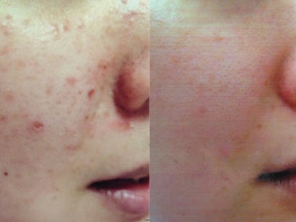 を使ったクチコミ(2枚目)