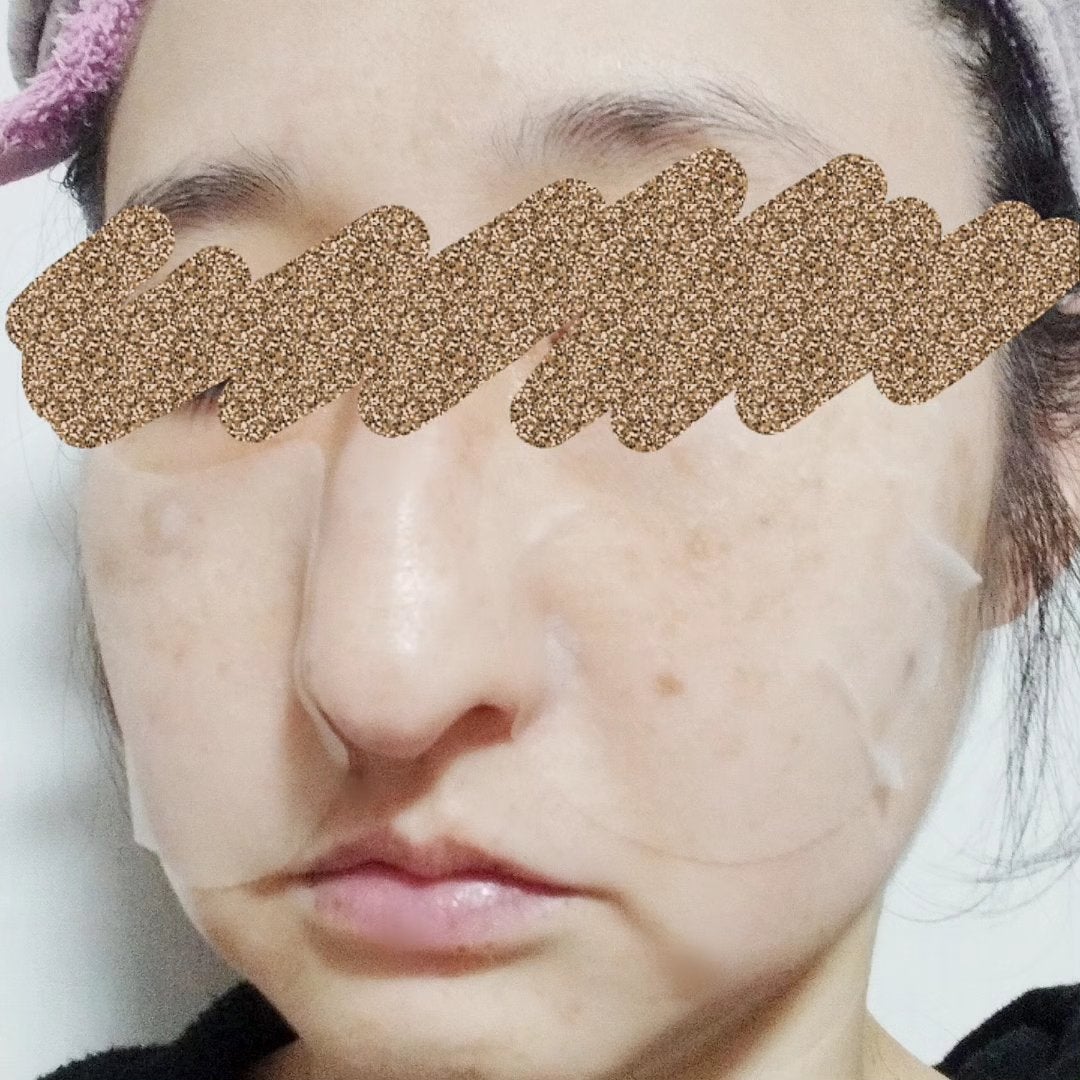 レッドブレミッシュクリアクイックスージングパック/Dr.G/拭き取り化粧水を使ったクチコミ(3枚目)