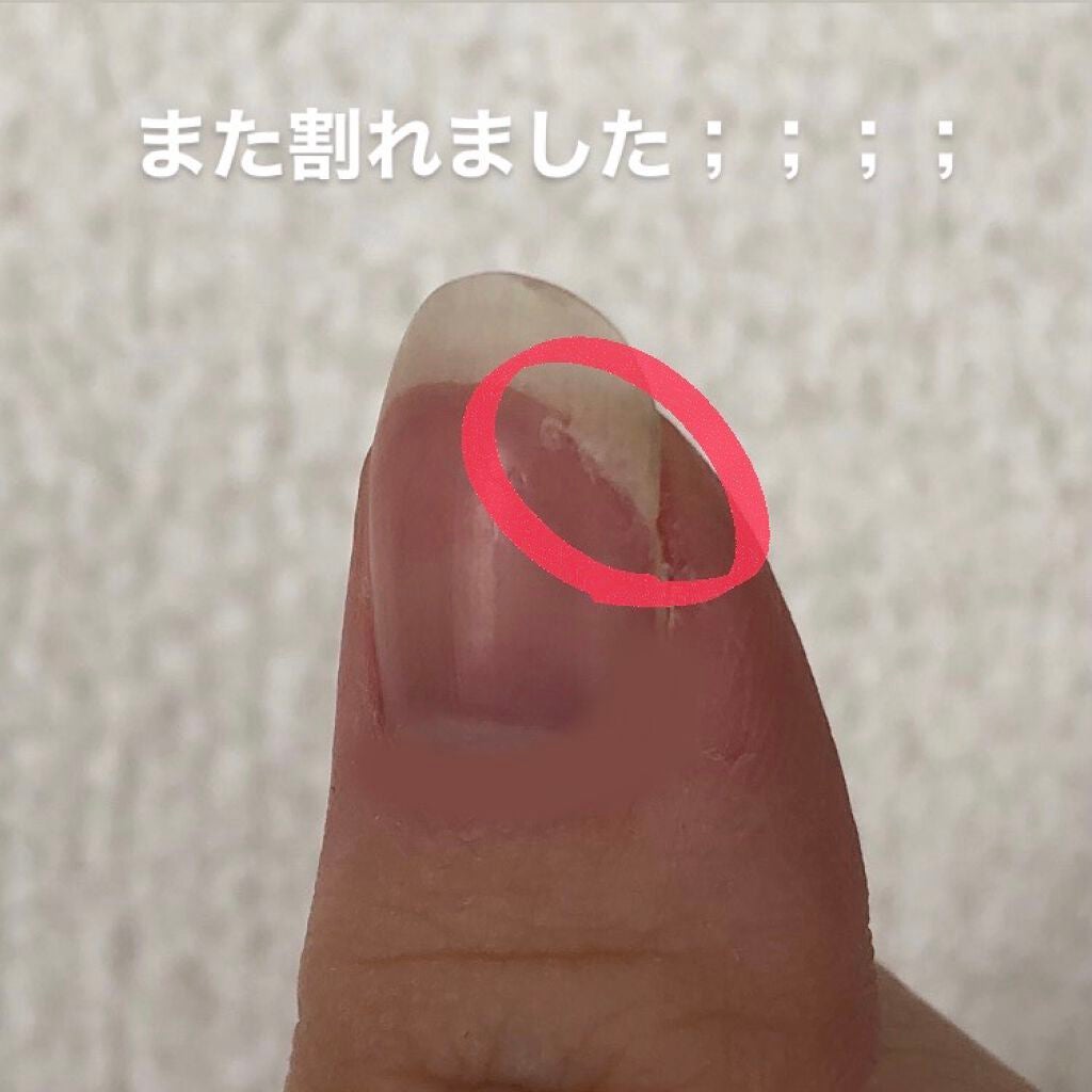 とまと on LIPS 「やっぱりこれしか勝たんでした。アロンアルファ!!!!見てくださ..」(2枚目)