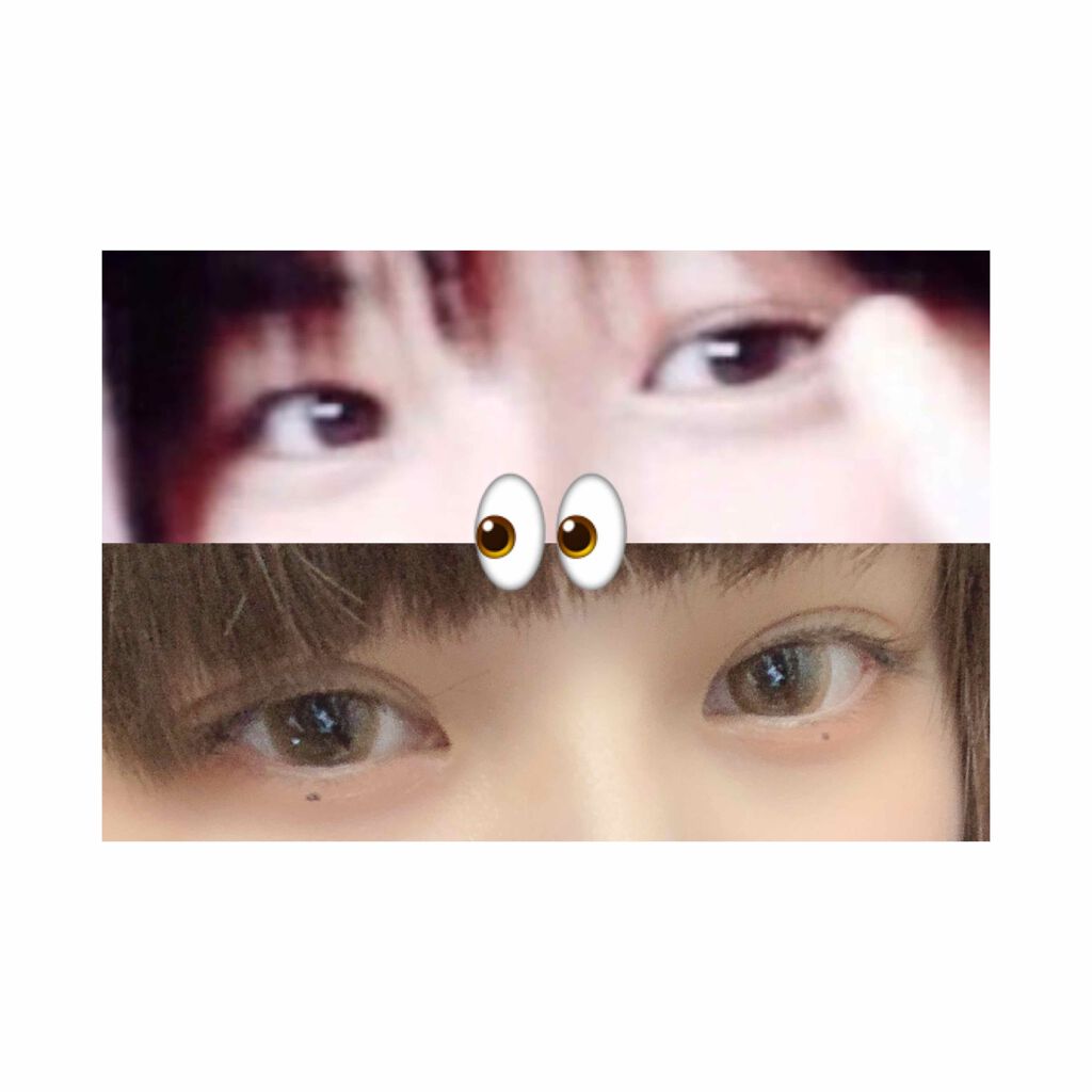 ケアリーヴ/ニチバン/その他を使ったクチコミ（1枚目）