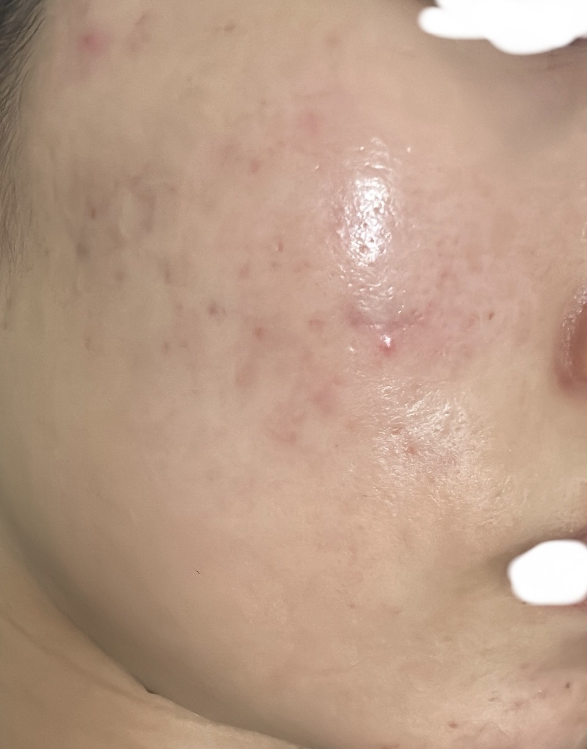 肌をうるおす保湿浸透水 バランシング/松山油脂/化粧水を使ったクチコミ（1枚目）