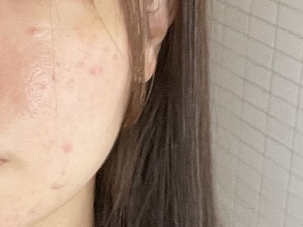 を使ったクチコミ（1枚目）