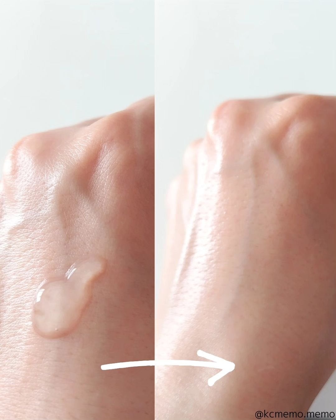 エーキュアスピキュールスポット/obsero/フェイスクリームを使ったクチコミ(8枚目)