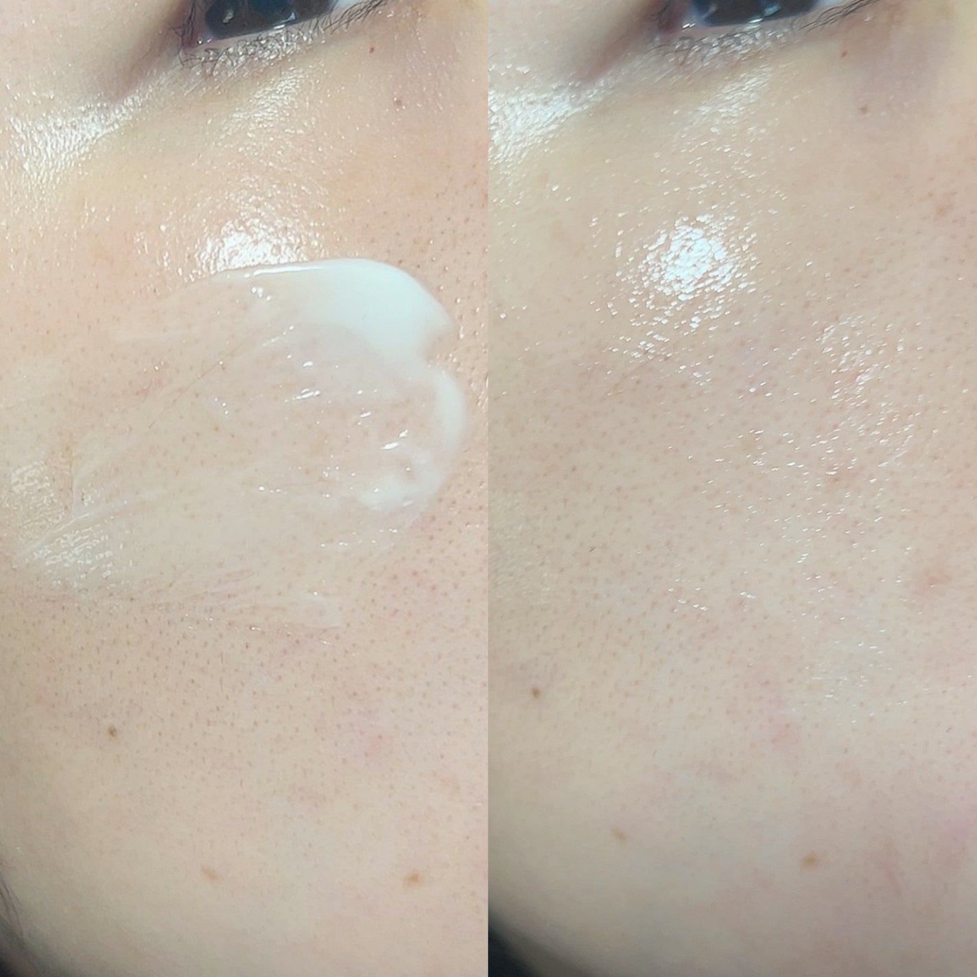 シカレチA クリーム0.05/VT/フェイスクリームを使ったクチコミ(4枚目)