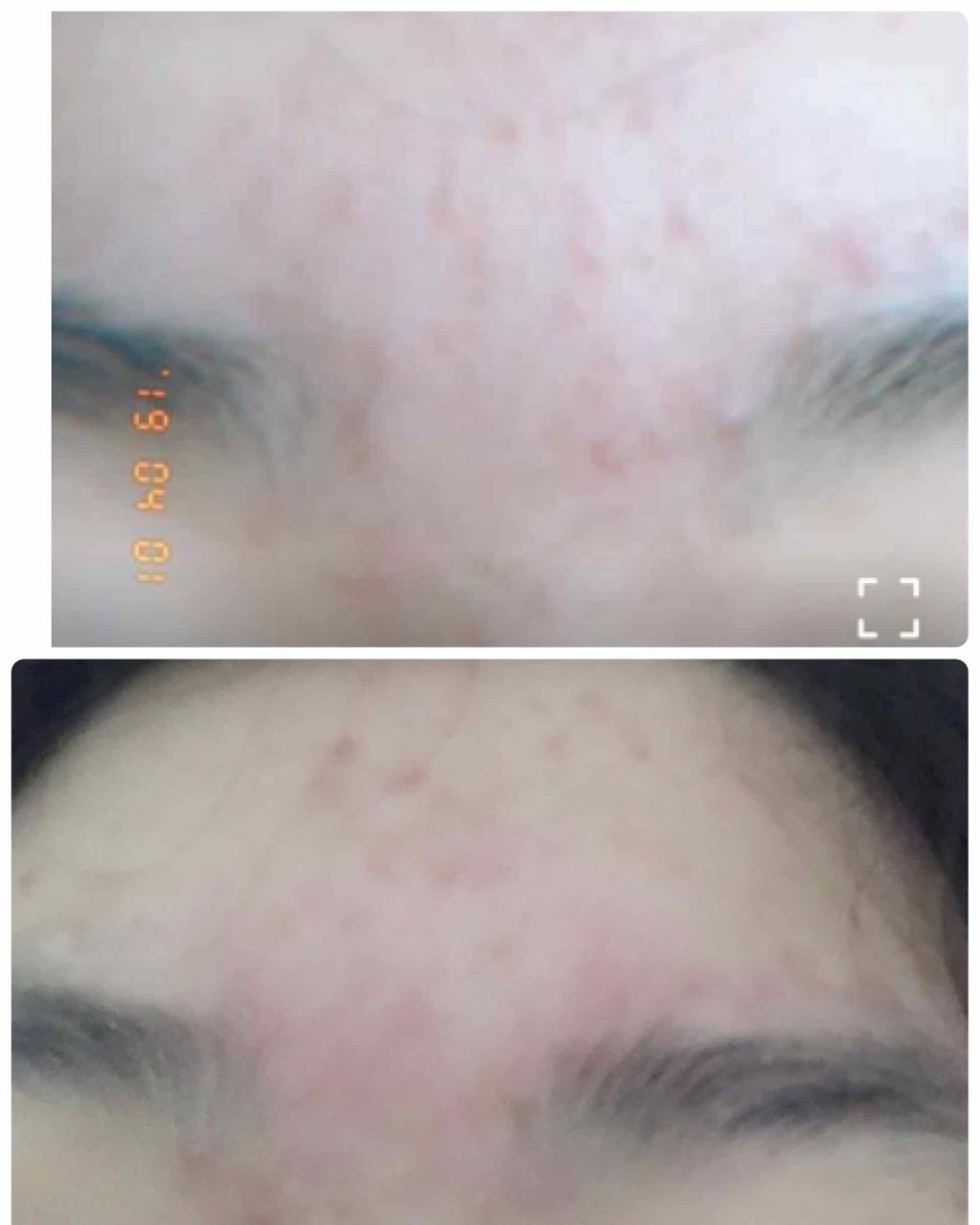 ビキ子 on LIPS 「こんにちは!ビキ子です。写真注意😱1週間プロジェクトの検証結果..」(4枚目)