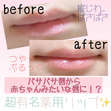 薬用リップクリーム Dhcの口コミ ひと塗りで赤ちゃんの唇に 超優秀薬用リッ By おもち フォロバ中 混合肌 Lips