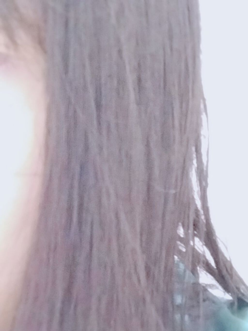 オキシドール(医薬品)/日本薬局方/その他を使ったクチコミ（2枚目）