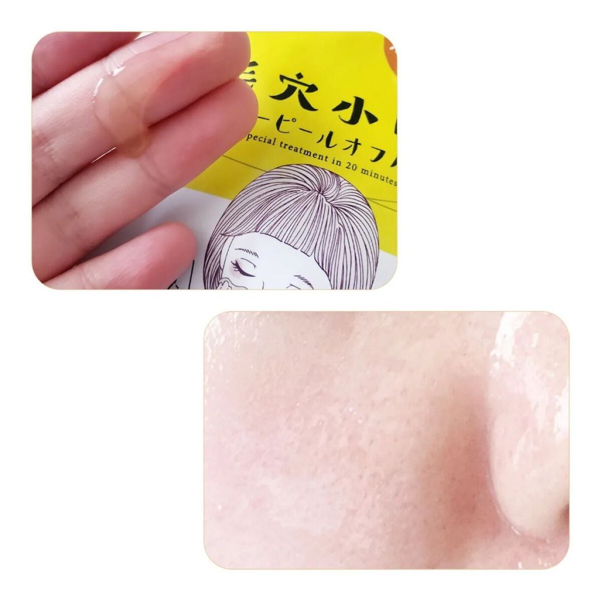 毛穴小町 イエローピールオフパック/クリアターン/ピーリングを使ったクチコミ(2枚目)