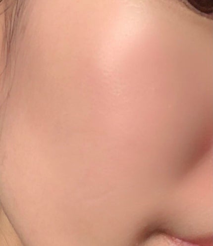 Wエッセンス/shimaboshi/美容液を使ったクチコミ(4枚目)