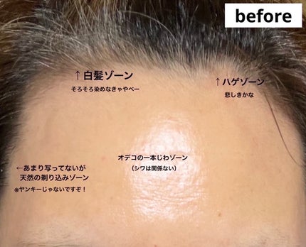 ヘアメイクパウダー/CEZANNE/ヘアケア・スタイリングを使ったクチコミ(5枚目)