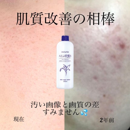 ハトムギ化粧水(ナチュリエ スキンコンディショナー R )/ナチュリエ/化粧水を使ったクチコミ(1枚目)