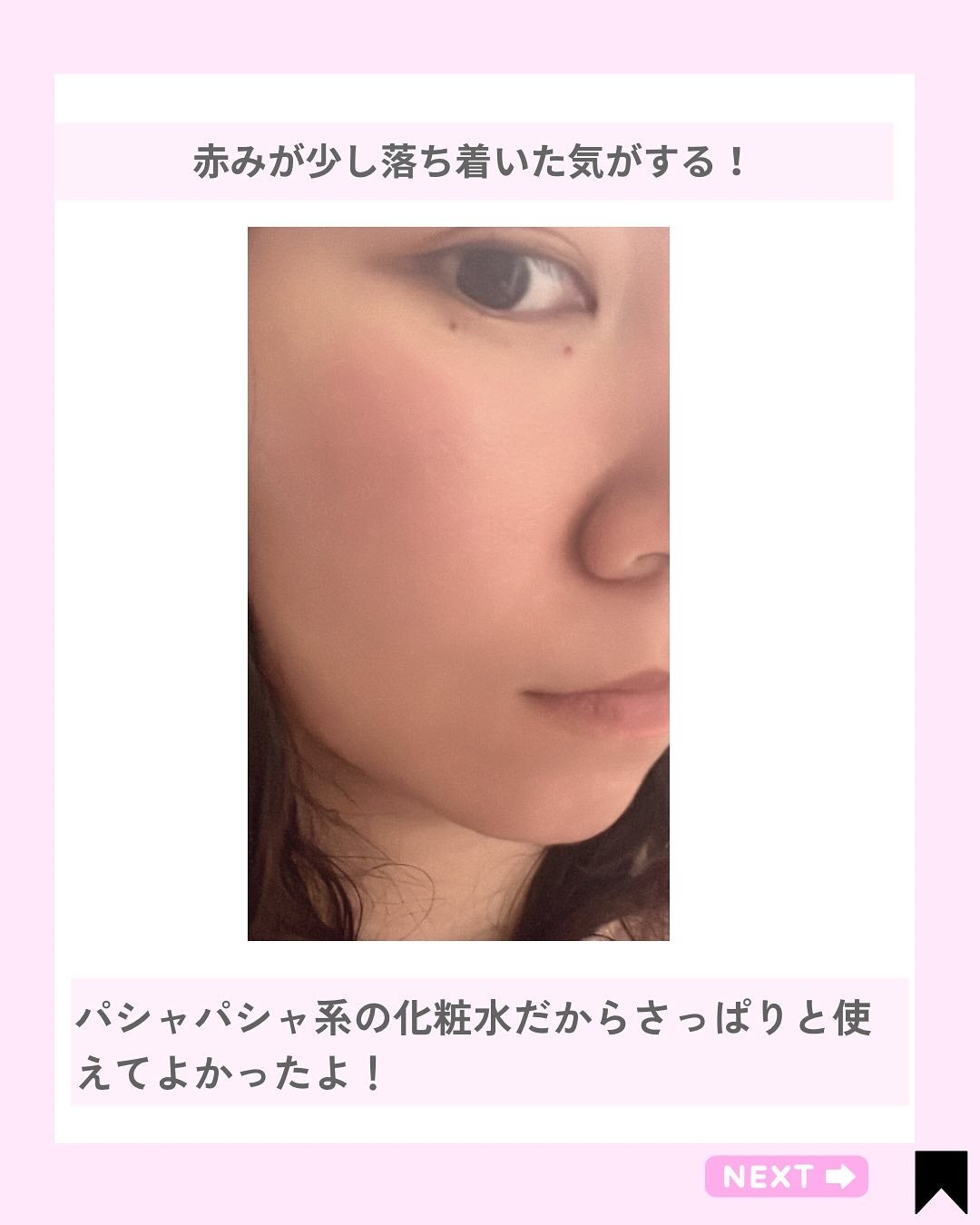 Kana on LIPS 「3草でNo肌荒れ♡@kana.cosme2525他の投稿はこち..」(4枚目)