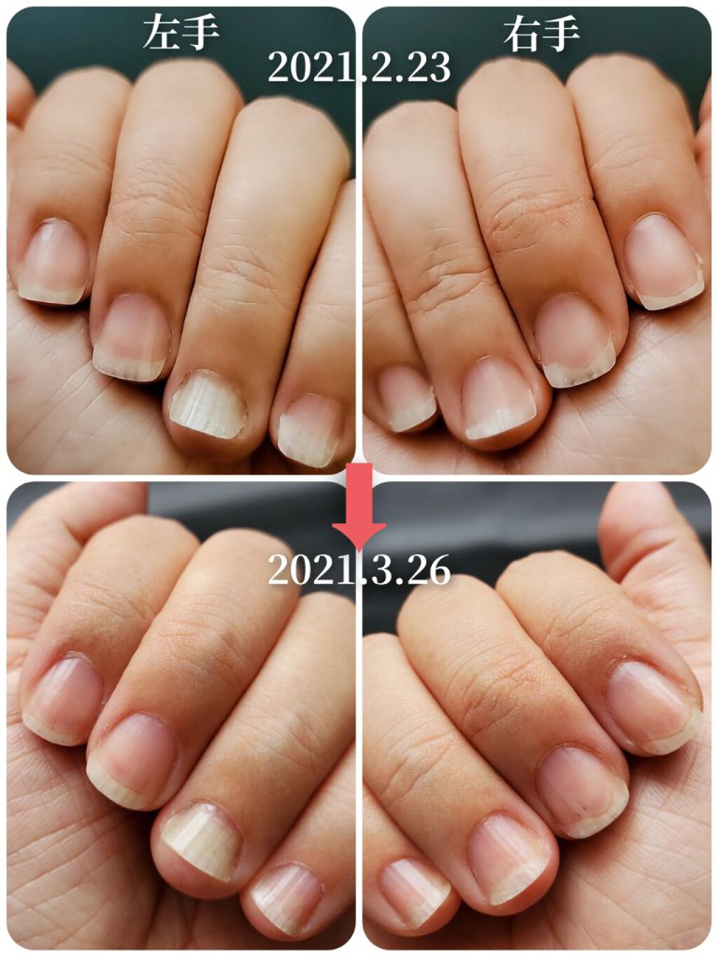 エテュセ クイックケアコート/ettusais/ネイルオイル・トリートメントを使ったクチコミ（3枚目）