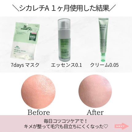 C−クエンスセラム 4プラス|エンビロンの使い方を徹底解説 C−クエンスセラム 4プラス|エンビロンの使い方を徹底解説