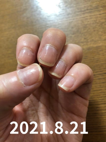 キューティクルオイル/ネイルホリック/ネイルオイル・トリートメントを使ったクチコミ(6枚目)
