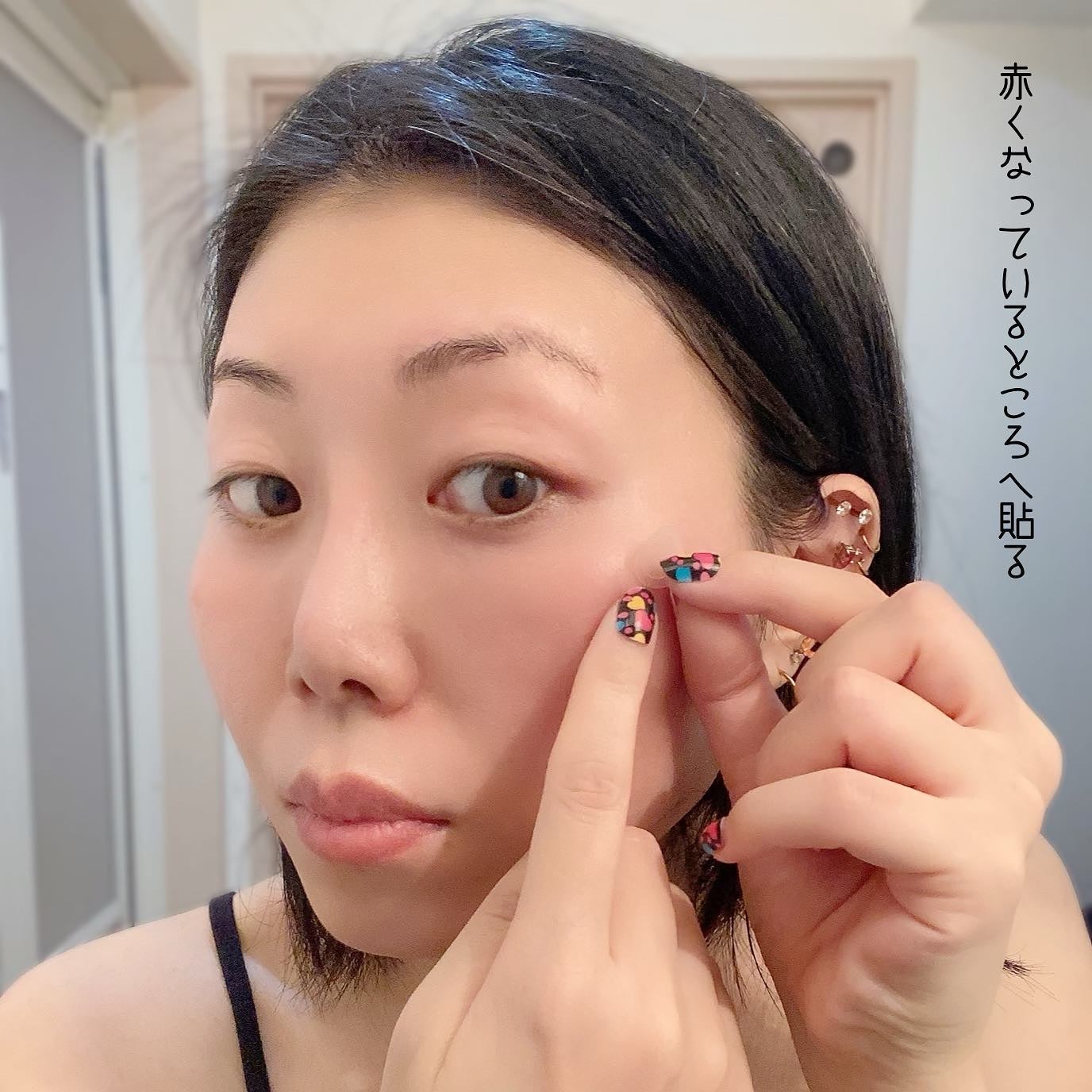 エーキュアショットスポットパッチ/obsero/にきびパッチを使ったクチコミ(6枚目)