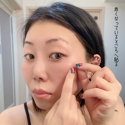 エーキュアショットスポットパッチ/obsero/にきびパッチを使ったクチコミ(6枚目)