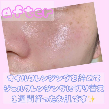 サンタマルシェ ディープクレンジング/サンタマルシェ/クレンジングジェルを使ったクチコミ(1枚目)