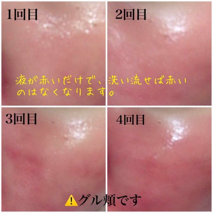 を使ったクチコミ(3枚目)