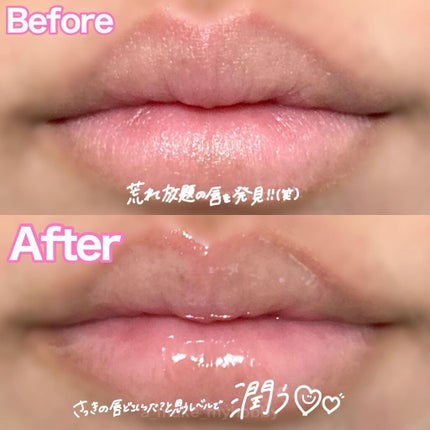 YNM リップトリートメントパック/YNM/リップマスクを使ったクチコミ(5枚目)
