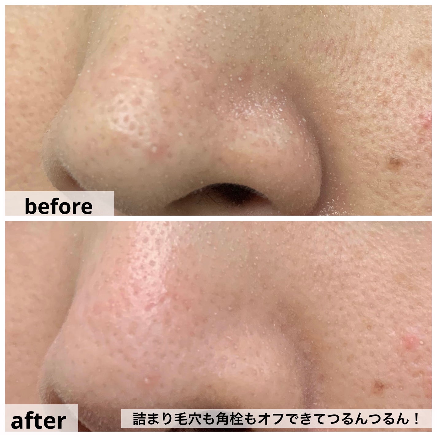 ソフィーナ iP ポア クリアリング ジェル ウォッシュ/SOFINA iP/その他洗顔料を使ったクチコミ(8枚目)