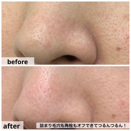 ソフィーナ iP ポア クリアリング ジェル ウォッシュ/SOFINA iP/その他洗顔料を使ったクチコミ(8枚目)