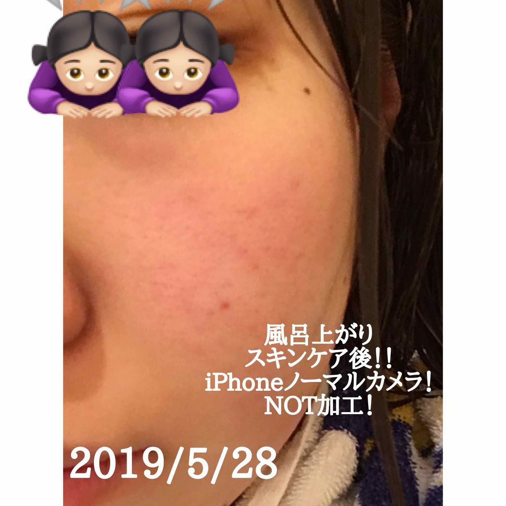 ディープクレンジングオイルW/ハイピッチ/オイルクレンジングを使ったクチコミ(3枚目)