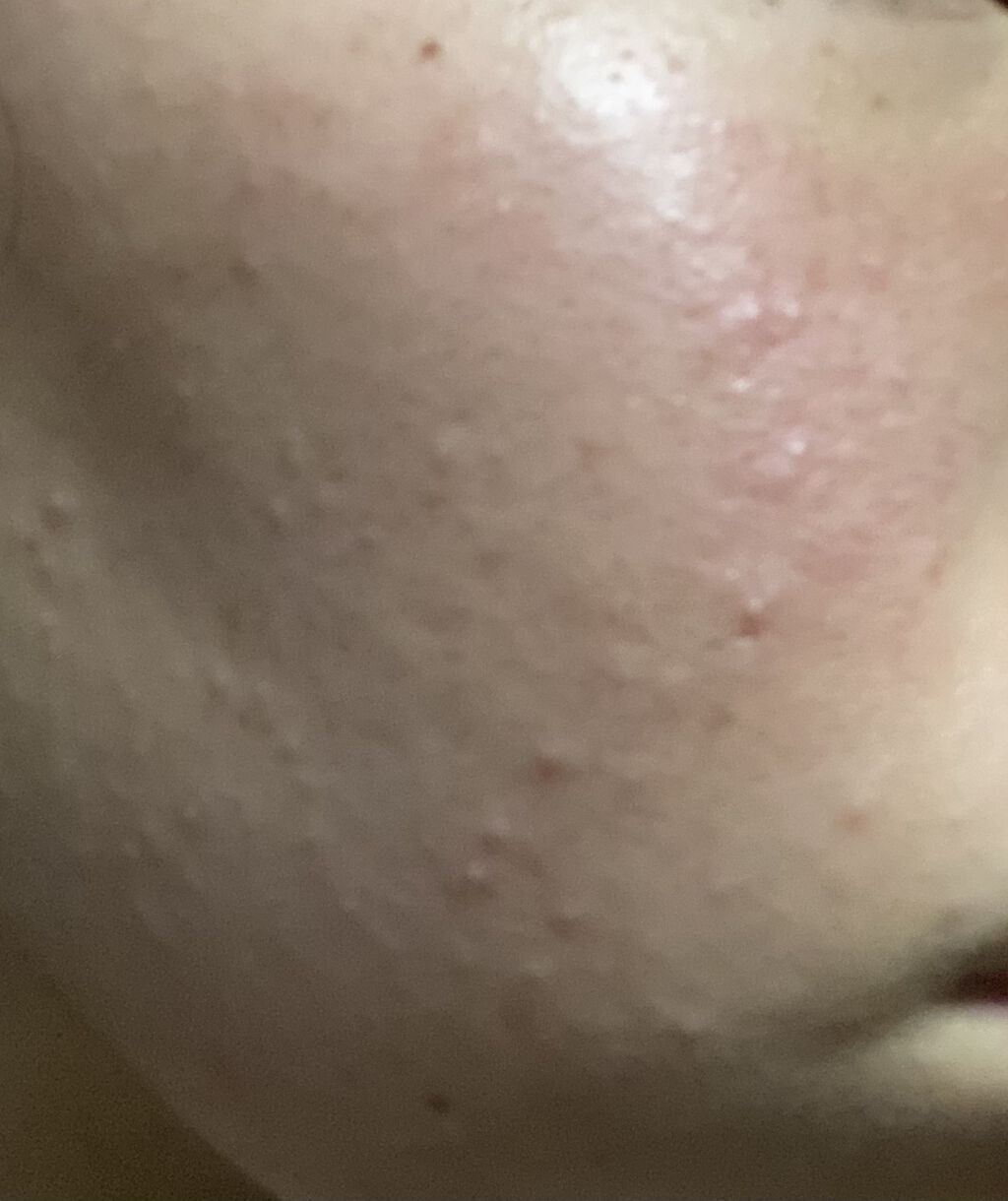 明色美顔水 薬用化粧水/美顔/化粧水を使ったクチコミ（1枚目）