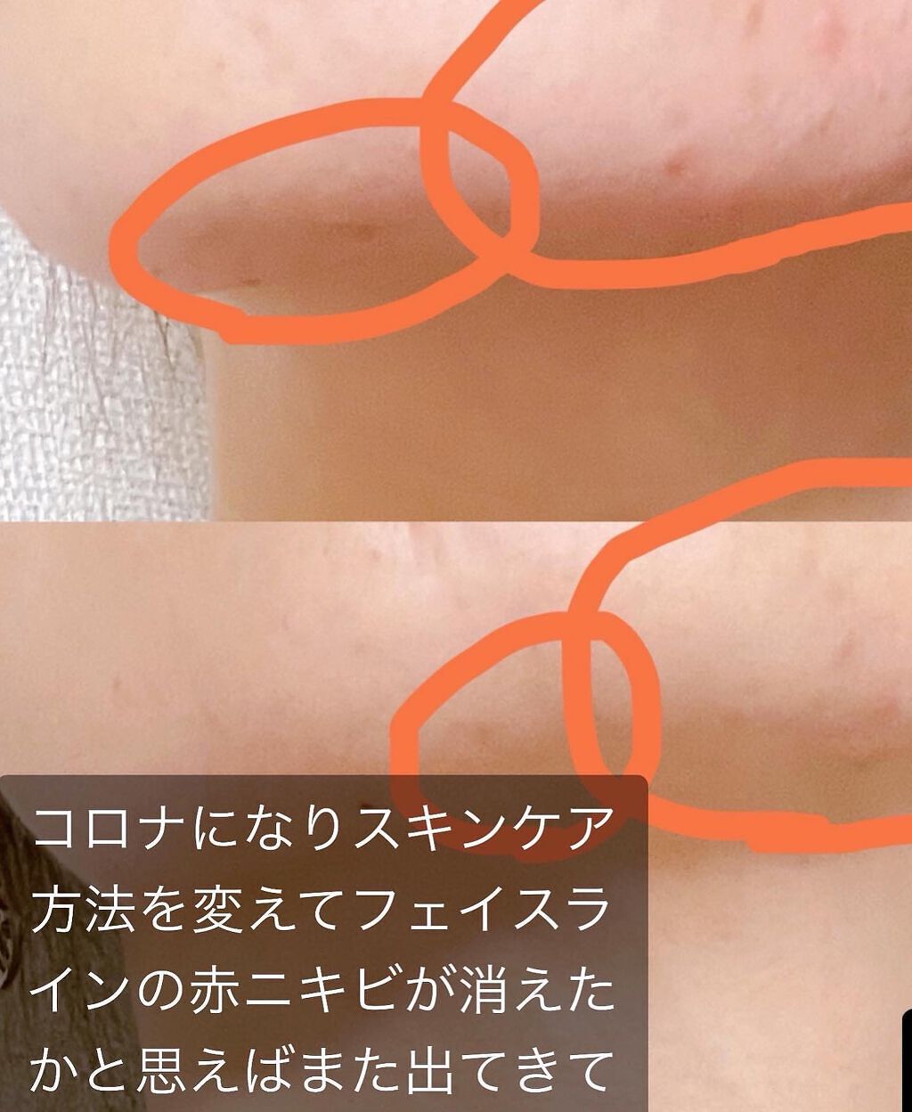 ビタブリッドC デイリーC バランシング クレンジングバーム/ビタブリッドジャパン/クレンジングバームを使ったクチコミ（3枚目）