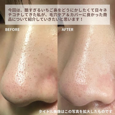 Glucolic Acid 30% Gel Peel/YEOUTH/ピーリングを使ったクチコミ（2枚目）