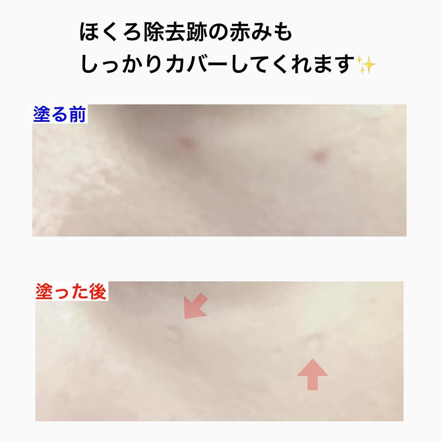 ロングラスティングチップコンシーラー/LUNA/リキッドコンシーラーを使ったクチコミ(4枚目)