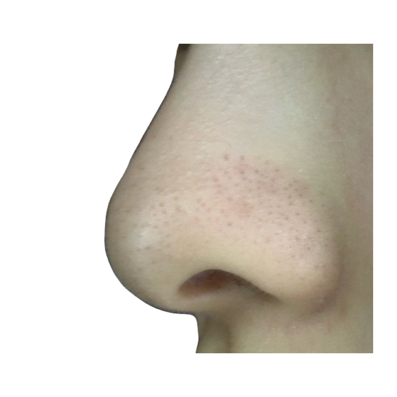 ノーモアブラックヘッド(ノーズピーリング)/One-day's you/スクラブ・ゴマージュを使ったクチコミ（3枚目）