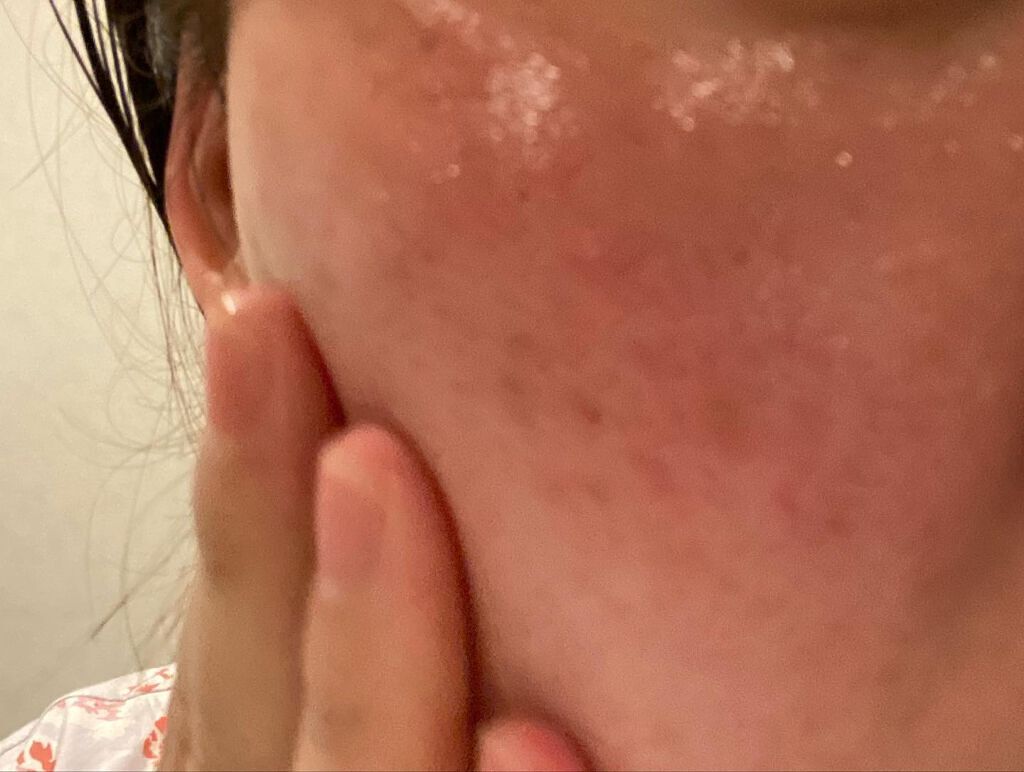 VC ブーストジェルウォッシュ/SKIO/その他洗顔料を使ったクチコミ(5枚目)