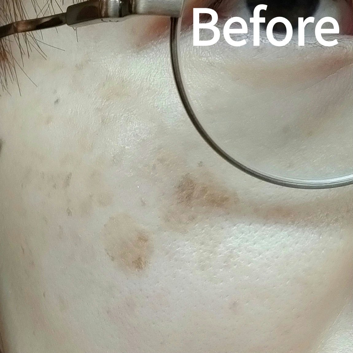 スポッツカバー ファウンデイション （コントロールカラー）C2/SHISEIDO/クリームコンシーラーを使ったクチコミ（2枚目）