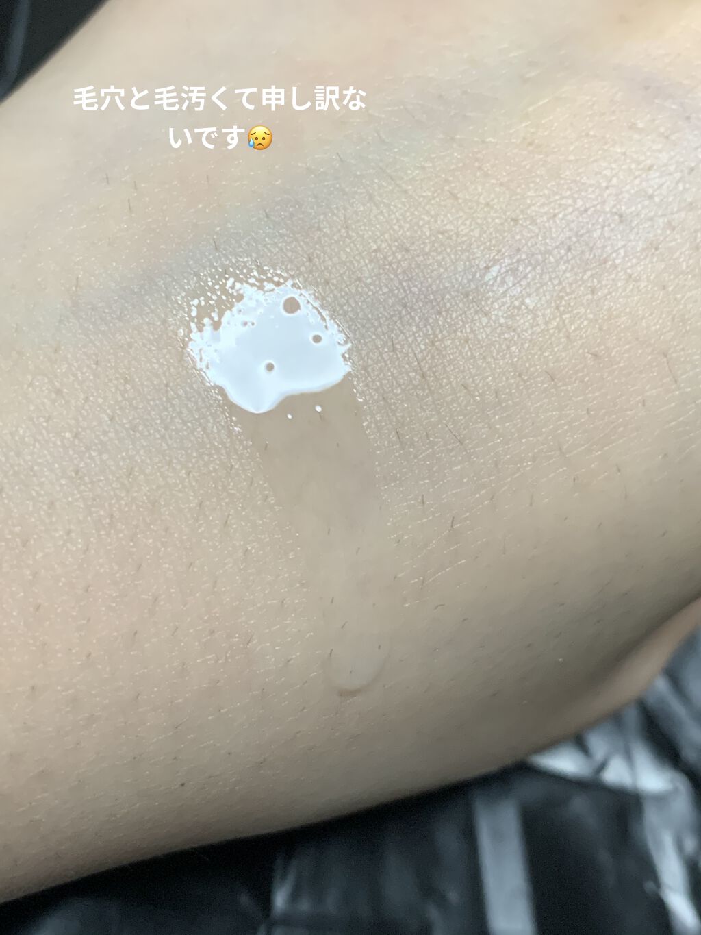 オバジC10セラム/オバジ/美容液を使ったクチコミ（2枚目）