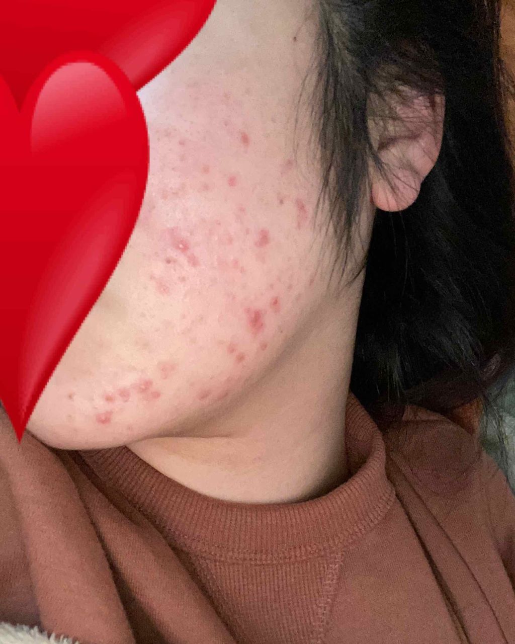 エリクシール ホワイト クリアエマルジョン C II/エリクシール/乳液を使ったクチコミ（2枚目）