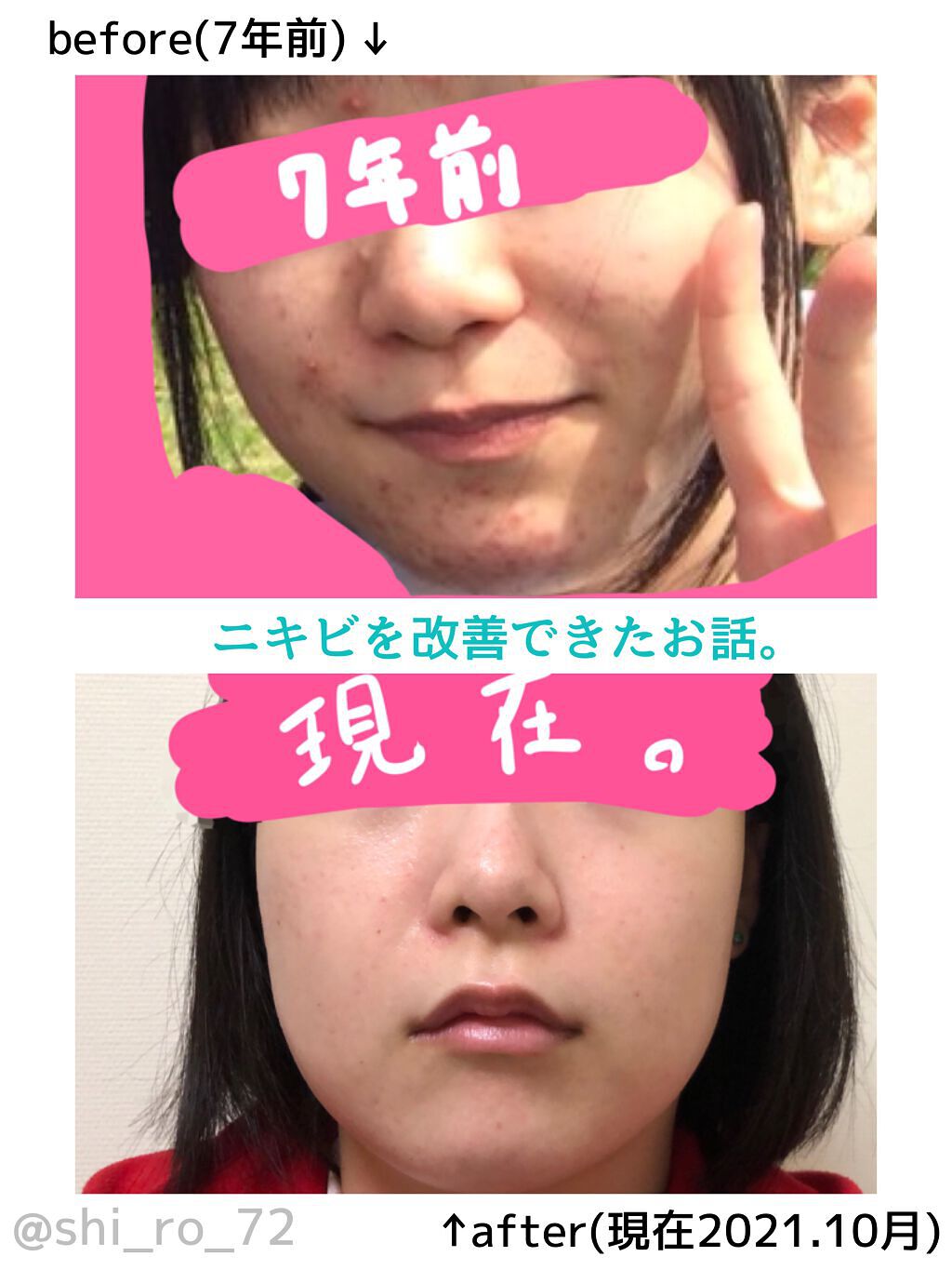 ミノン アミノモイスト モイストチャージ ミルク/ミノン/乳液を使ったクチコミ（2枚目）