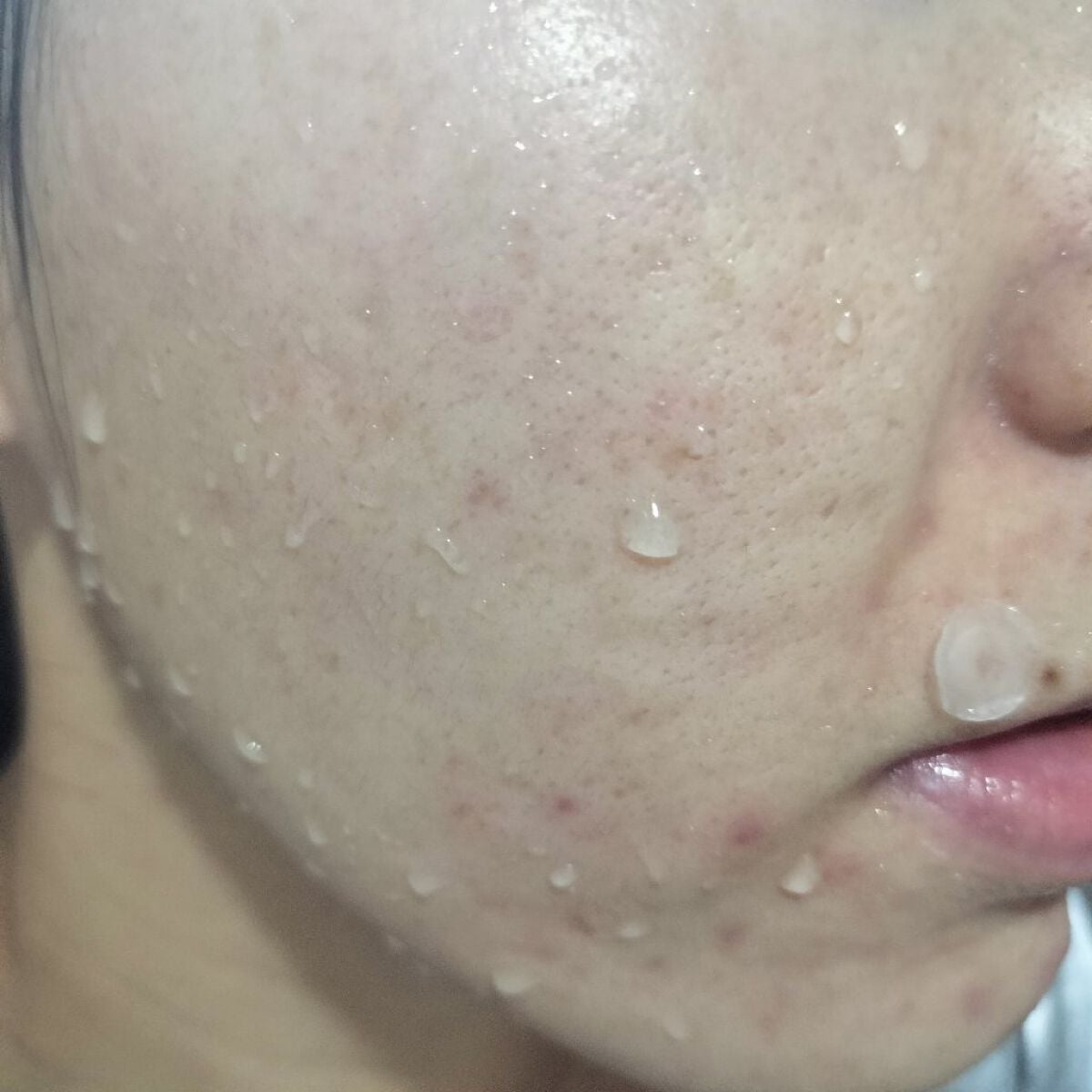 miina@汚肌工事録⚠️ on LIPS 「✍11/10の#汚肌工事録いつも優しく見守ってくれるみなさん、..」(1枚目)