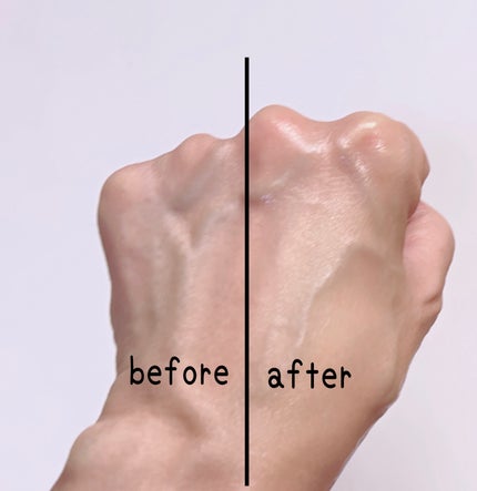 マデカバイタルカプセルセラム/センテリアン24/美容液を使ったクチコミ(6枚目)