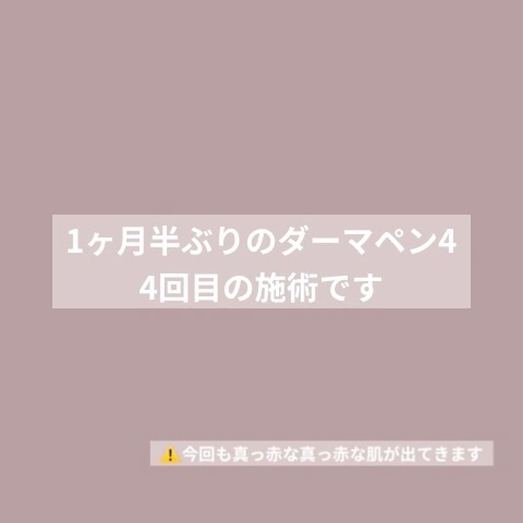aiko on LIPS 「⚠️写真も真っ赤な肌が出てきます😣しかも写真の撮り方めっちゃ下..」(1枚目)
