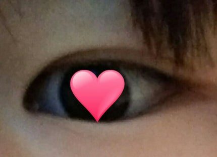 アイトーク/アイトーク/二重まぶた用アイテムを使ったクチコミ(1枚目)