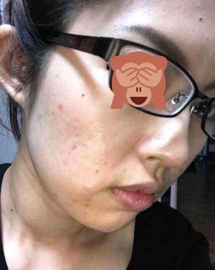 大豆イソフラボン 吸収型/DHC/健康サプリメントを使ったクチコミ(3枚目)