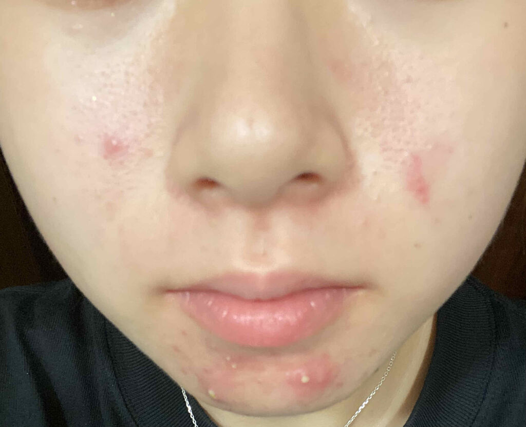 サンシビオ エイチツーオー D/ビオデルマ/クレンジングウォーターを使ったクチコミ（2枚目）