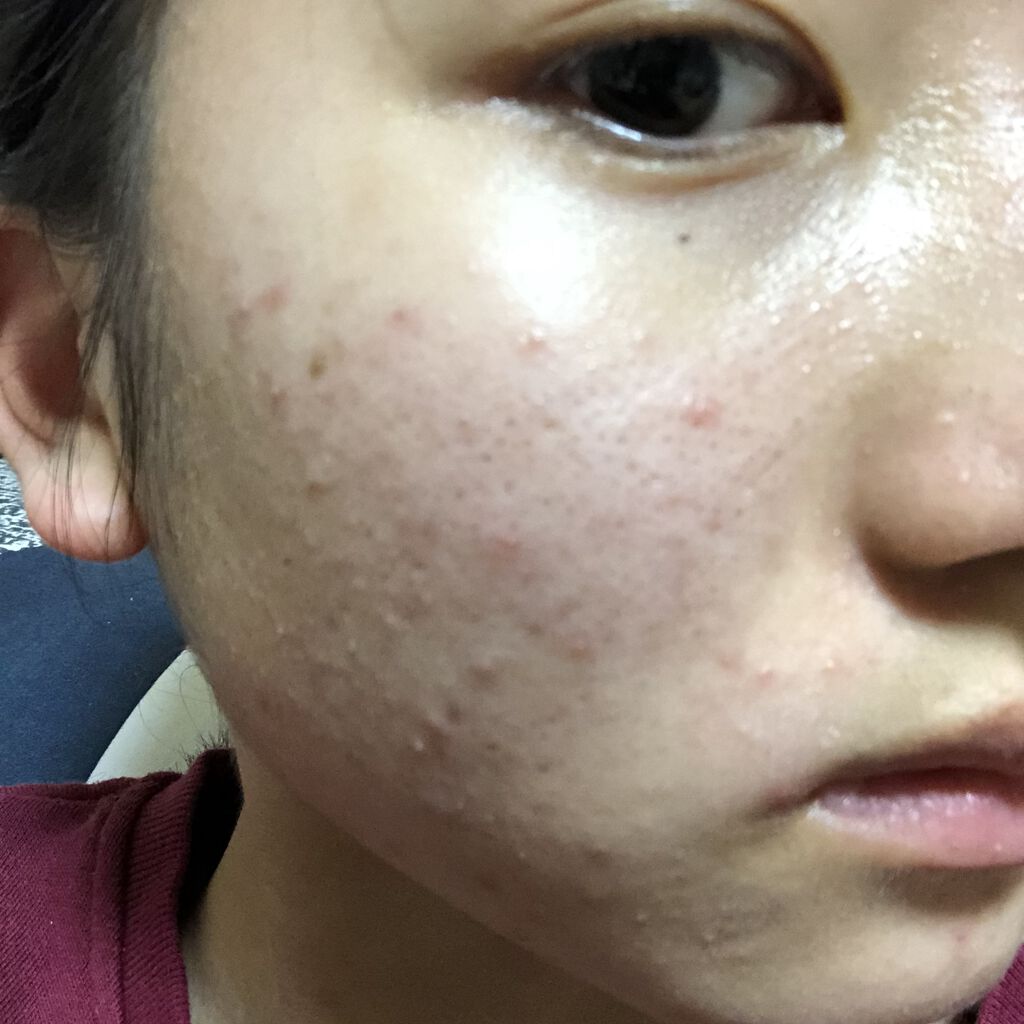 明色美顔水 薬用化粧水/美顔/化粧水を使ったクチコミ（2枚目）