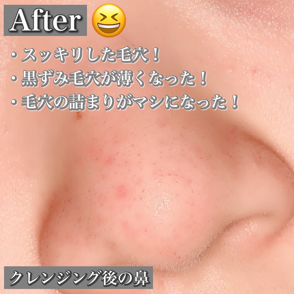 クレンジングバーム ブラック/CLAYGE/クレンジングバームを使ったクチコミ(3枚目)