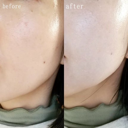 パワーブライトニング グルタチオンクリーム/Dr.Althea/フェイスクリームを使ったクチコミ(5枚目)