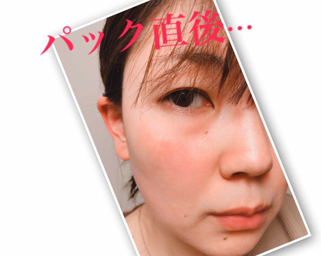 オリジナル ピュアスキンジェリー/ヴァセリン/ボディクリームを使ったクチコミ（3枚目）